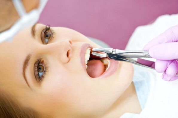 tooth extraction and alcohol consumption